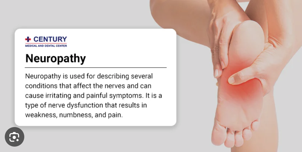 Dietary supplements can help to manage neuropathy effectively when taken the right way. The good thing about nutritional supplements is that they have fewer or no side effects as compared to other medications or treatment methods. They can boost your condition by ensuring your body gets the required amount of whichever nutrient is lacking in your body. Taking these nutrients in supplement form benefits your health and wellbeing in various other ways too.